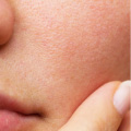 Treatment Image 11