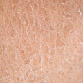 Treatment Image 6