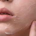 Treatment Image 8